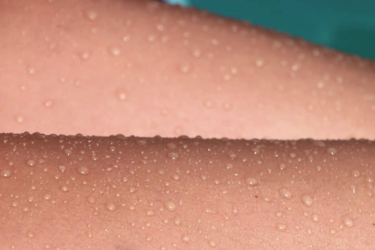 Naturkosmetik Pigmentflecken