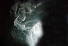 Weihrauch: Das Geschenk der Könige Weihrauch