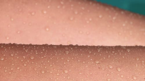 pigmentflecken_wassertropfen-haut